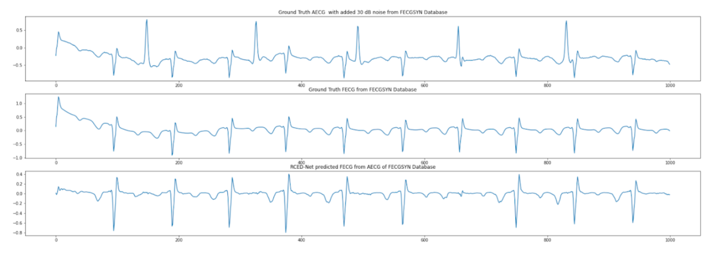 Fetal ECG separation from abdominal ECG using RCED-net